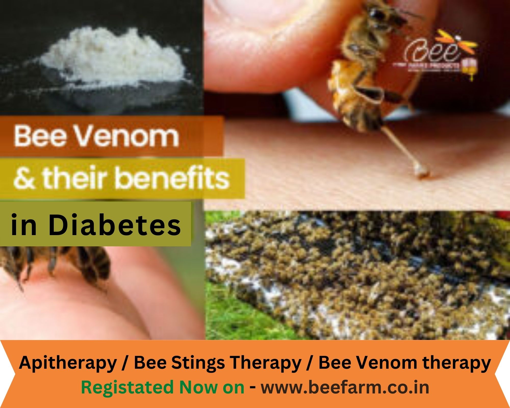 Bee Venom Benefits in Diabetes